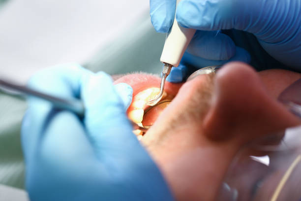 Best Weekend Emergency Dentist in Sansom Park, TX