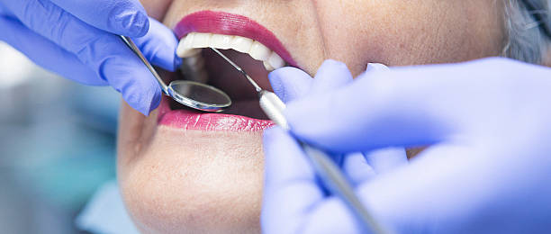 Best Emergency Root Canal Treatment in Sansom Park, TX