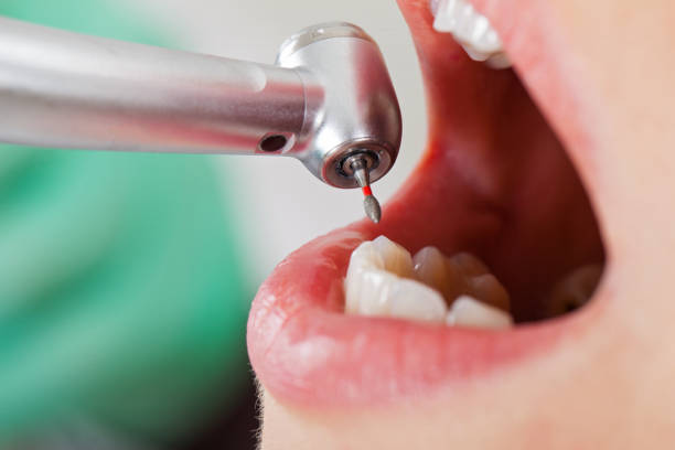 Best Emergency Broken Tooth Repair in Sansom Park, TX